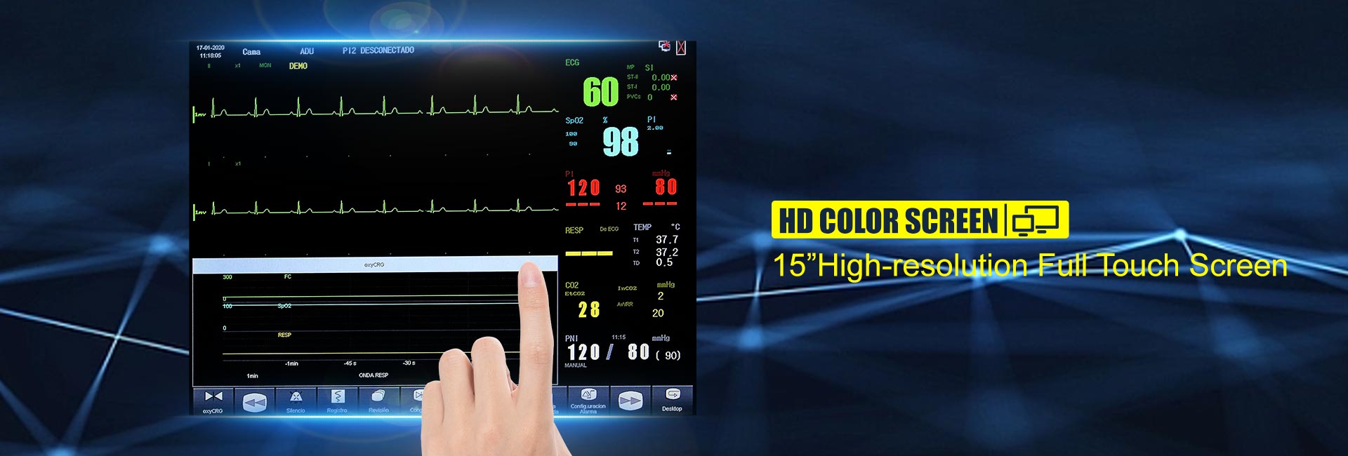 iS15 Pro 15 Modular Patient Monitor(图3)